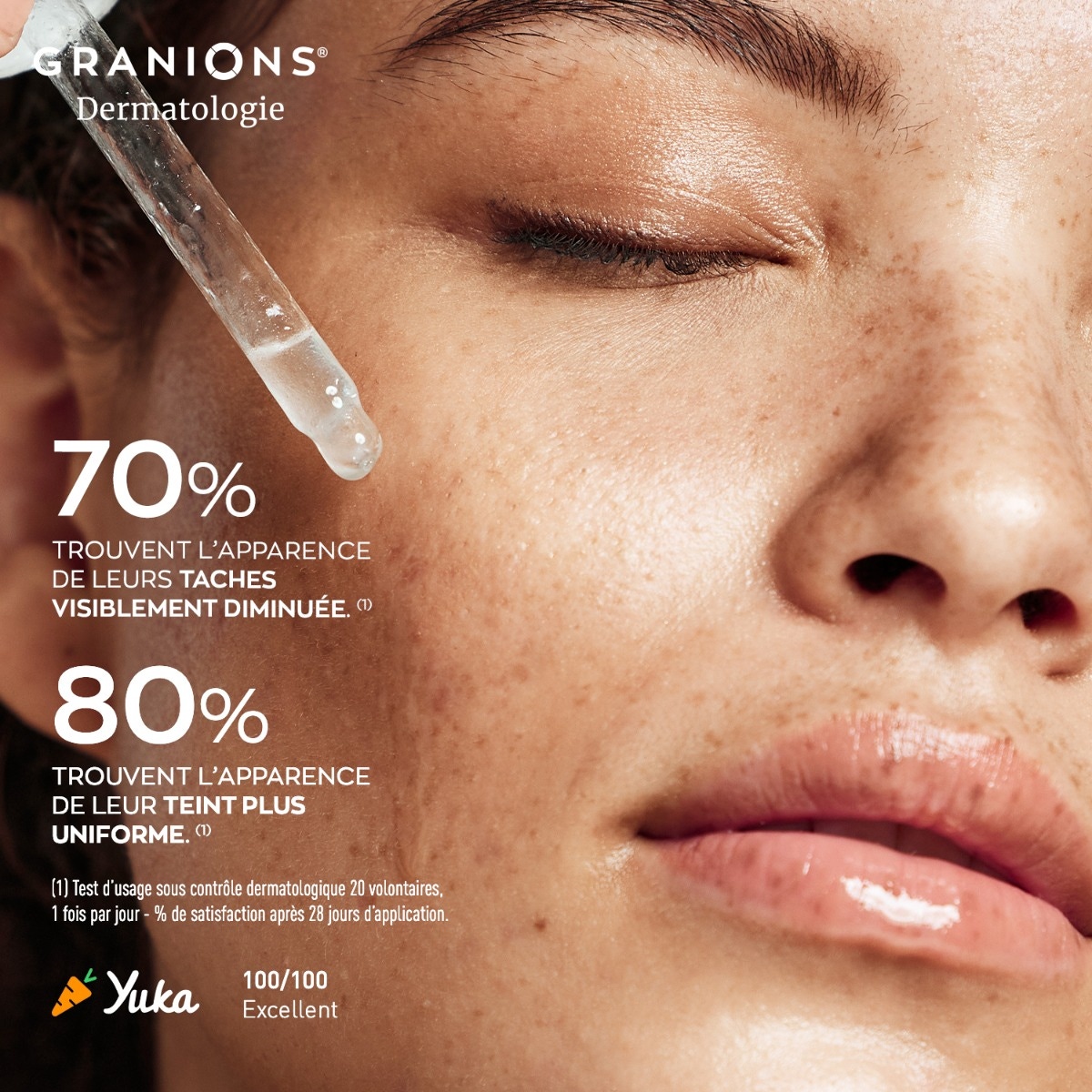 Sérum Anti-Taches – Niacinamide 12%